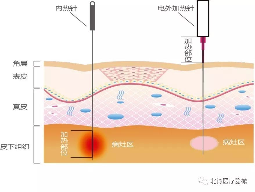 三大方案 (3)